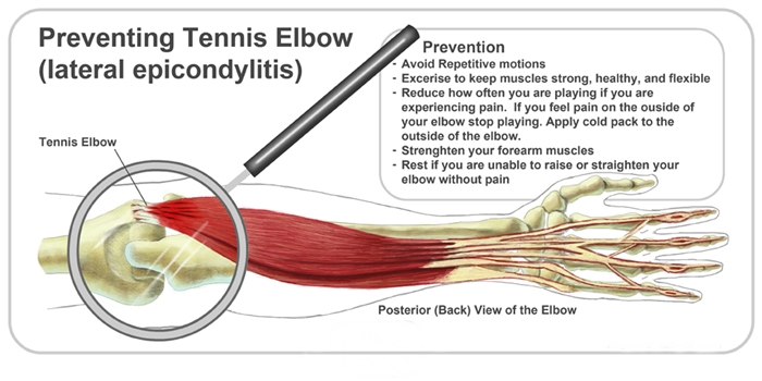 What Causes Elbow Pain? Facts You Need To Know! Urgent