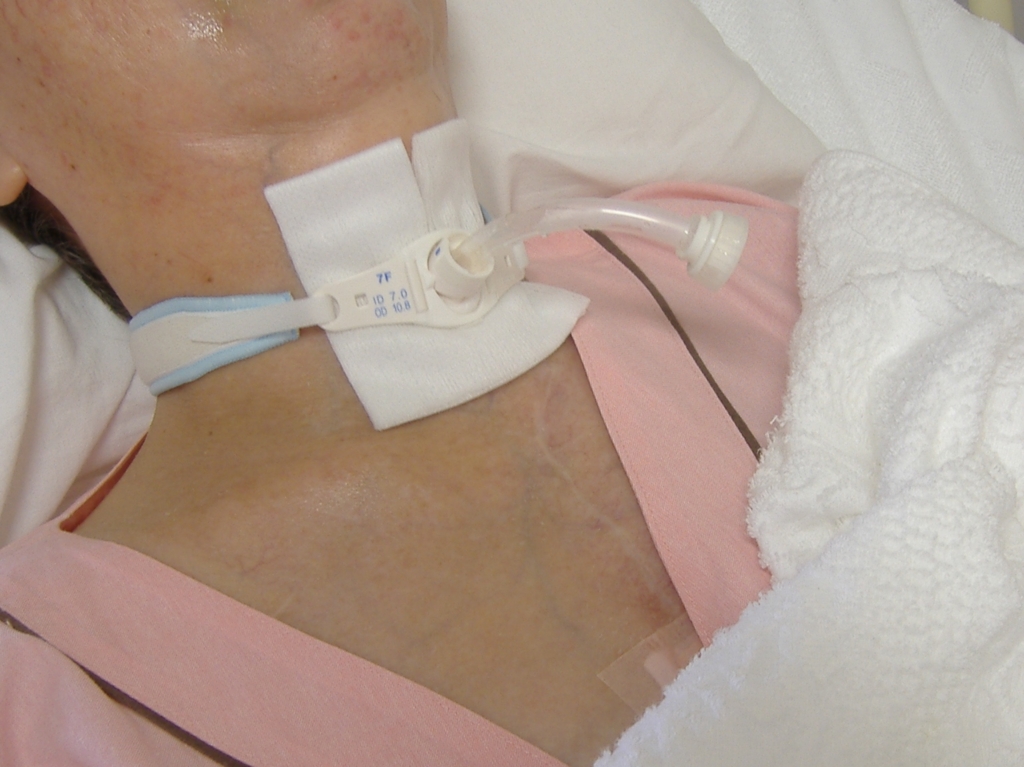 f:id:MAIKALFUJIO:20150831000528j:plain f:id:MAIKALFUJIO:20150831000528j:plain