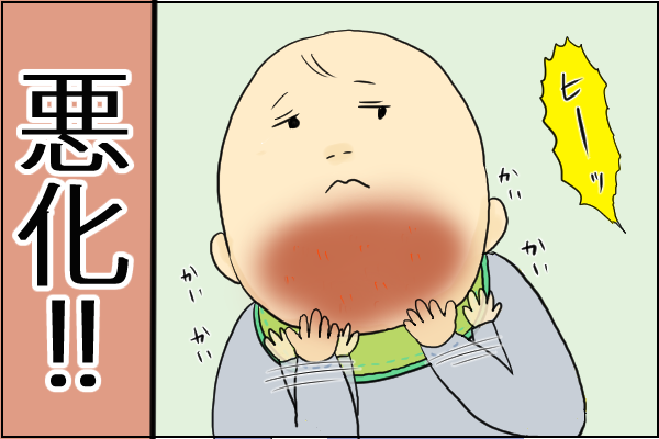 f:id:akasuguedi:20160628083807p:plain
