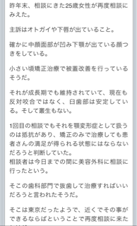 f:id:akawhatalife:20150303215553j:plain f:id:akawhatalife:20150303215553j:plain