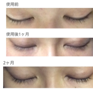 f:id:akawhatalife:20150418173409j:plain f:id:akawhatalife:20150418173409j:plain