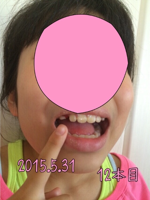 f:id:aohana:20150601152231j:image f:id:aohana:20150601152231j:image