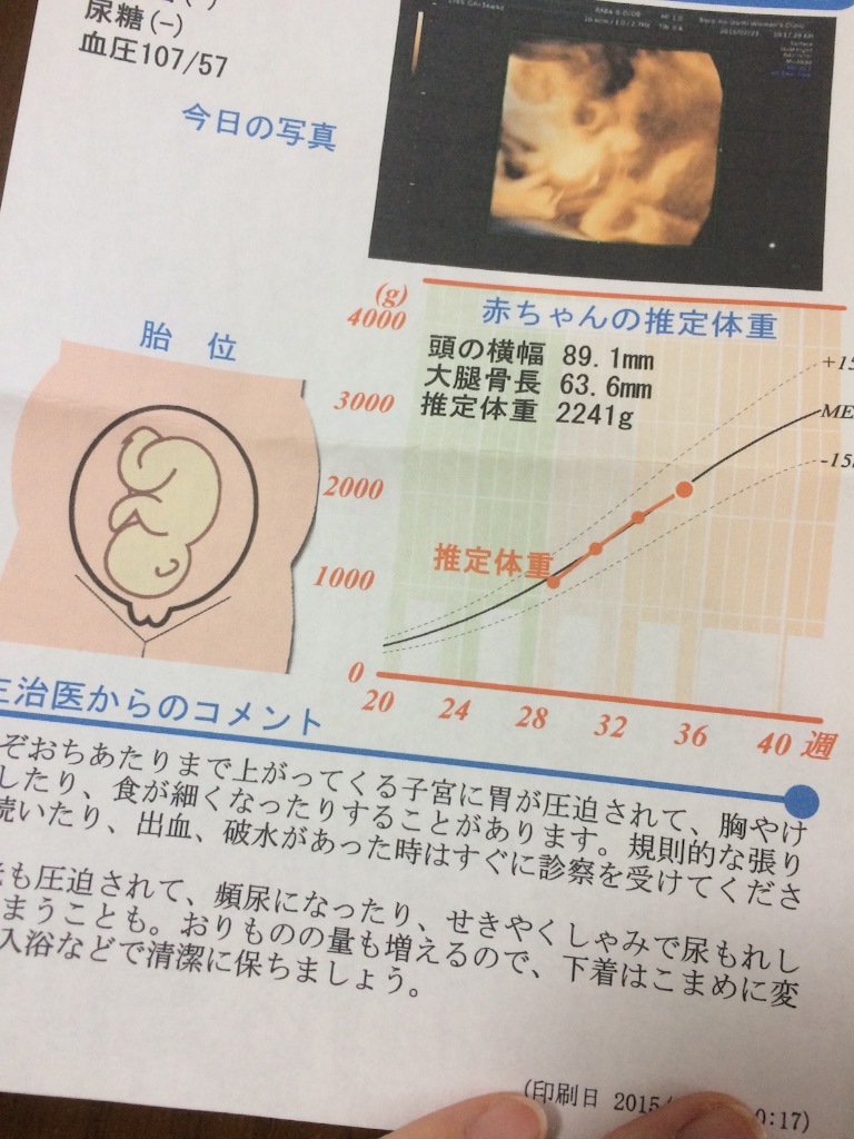 f:id:aohana:20150723184848j:image f:id:aohana:20150723184848j:image