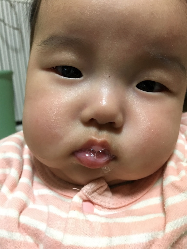 f:id:aohana:20151222183913j:image f:id:aohana:20151222183913j:image