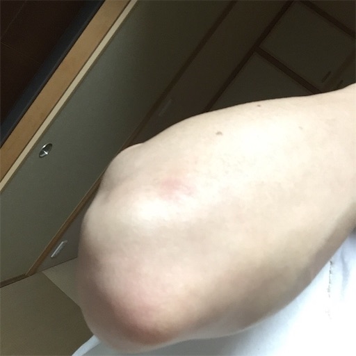f:id:asako415:20160601215821j:image f:id:asako415:20160601215821j:image