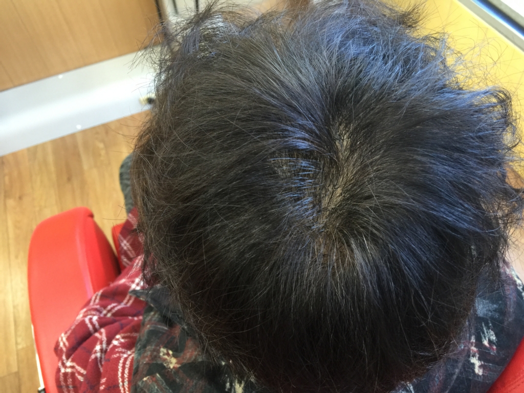 f:id:ayuturi40:20160121120341j:plain f:id:ayuturi40:20160121120341j:plain