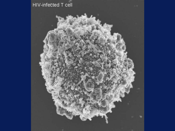 f:id:beauty-box:20150614200139p:plain HIV(ヒト免疫不全)ウイルス