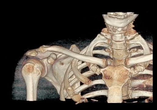 f:id:best_wishes:20150211012424p:plain