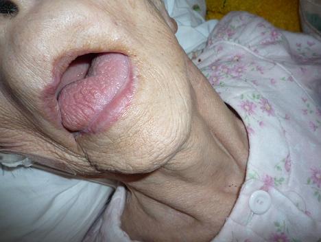 f:id:biei-jikoukai:20160609190212j:plain f:id:biei-jikoukai:20160609190212j:plain