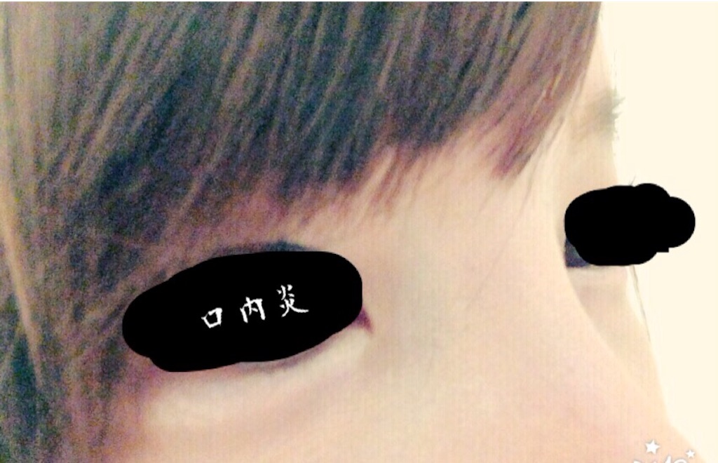 f:id:biyouseikeijoshidaisei:20150929121507j:image f:id:biyouseikeijoshidaisei:20150929121507j:image