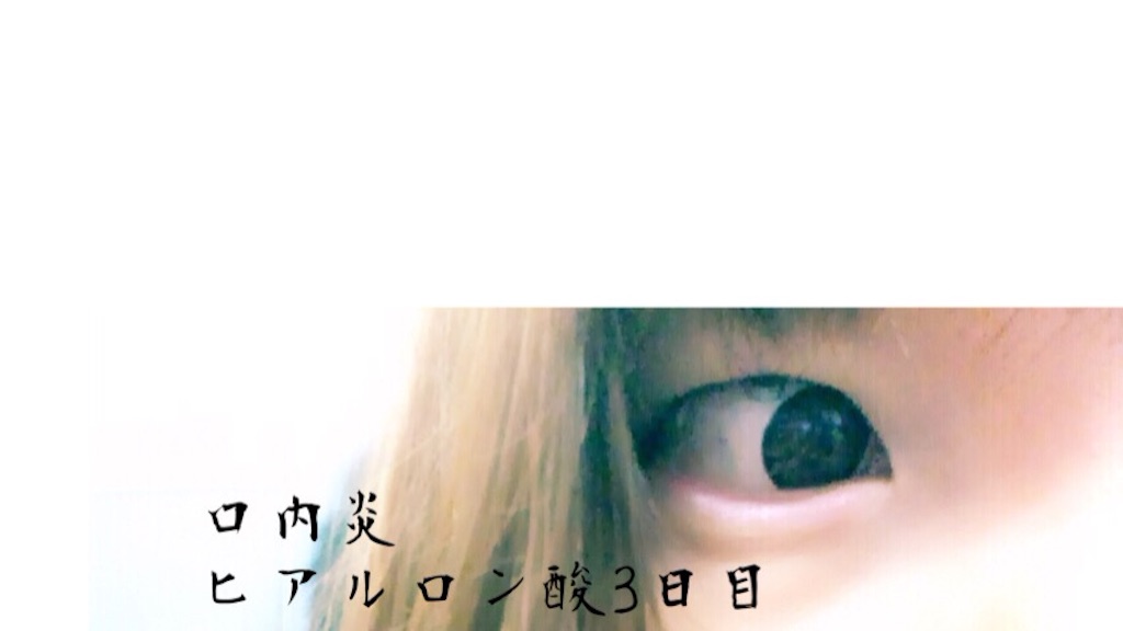 f:id:biyouseikeijoshidaisei:20150929122426j:image f:id:biyouseikeijoshidaisei:20150929122426j:image