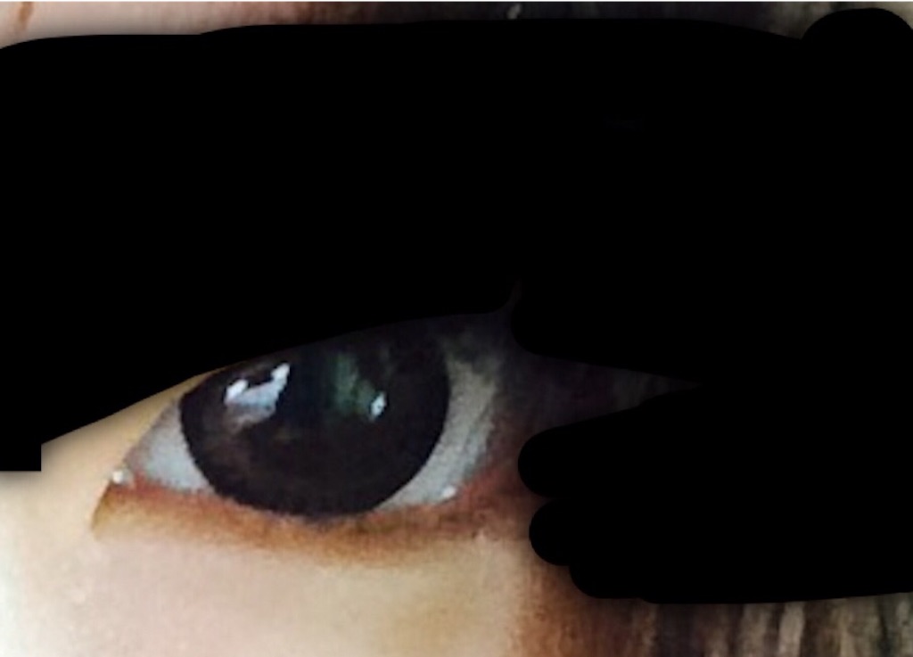 f:id:biyouseikeijoshidaisei:20151005033750j:image f:id:biyouseikeijoshidaisei:20151005033750j:image