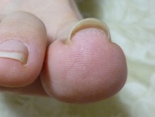 f:id:blessglassnail:20150106144201j:plain f:id:blessglassnail:20150106144201j:plain
