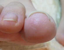 f:id:blessglassnail:20150106144258j:plain f:id:blessglassnail:20150106144258j:plain