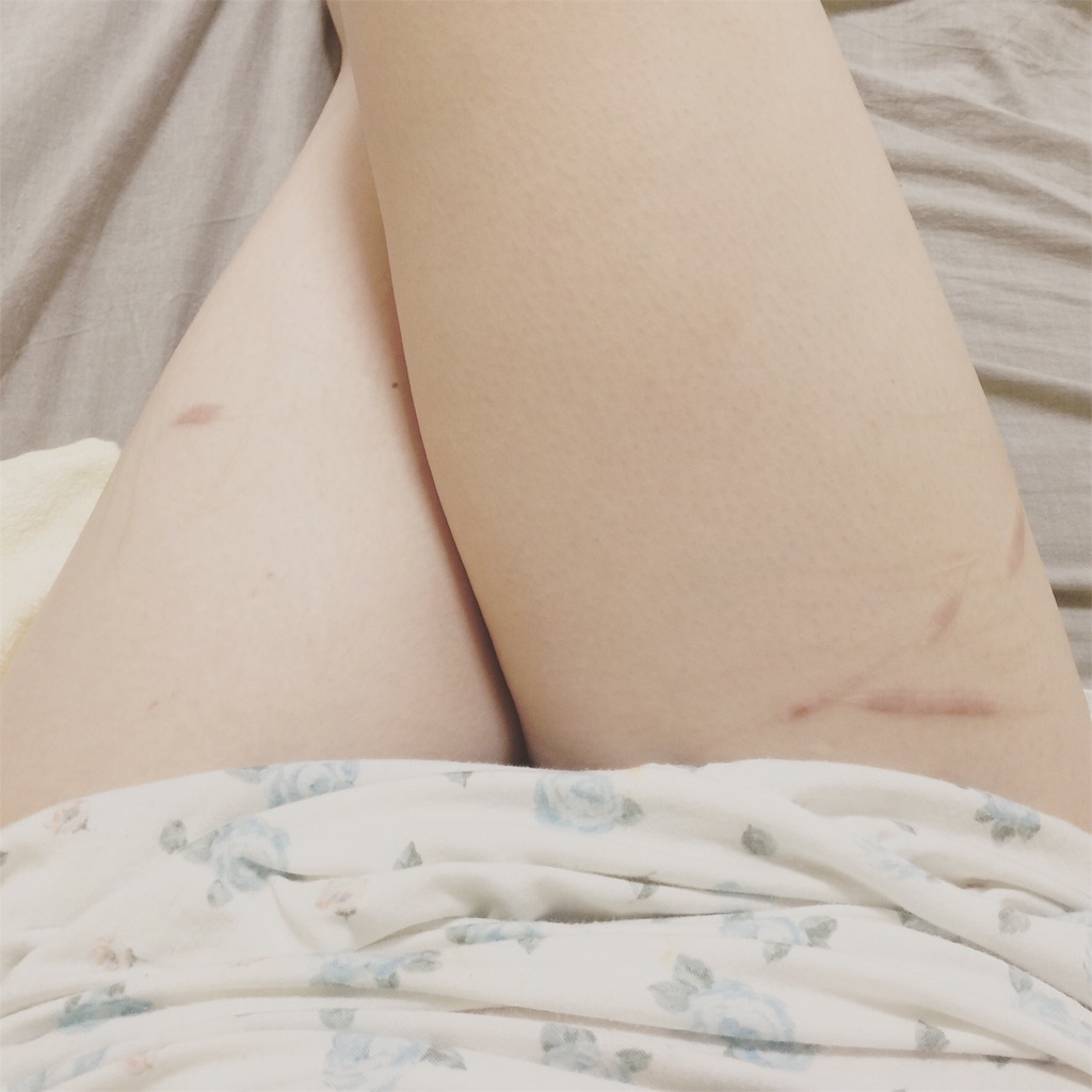 f:id:ensei_diary:20151013183655j:image f:id:ensei_diary:20151013183655j:image