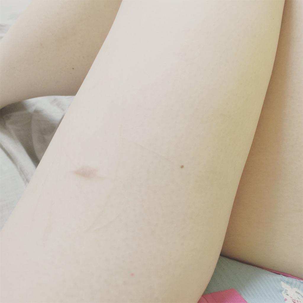 f:id:ensei_diary:20151013183714j:image f:id:ensei_diary:20151013183714j:image