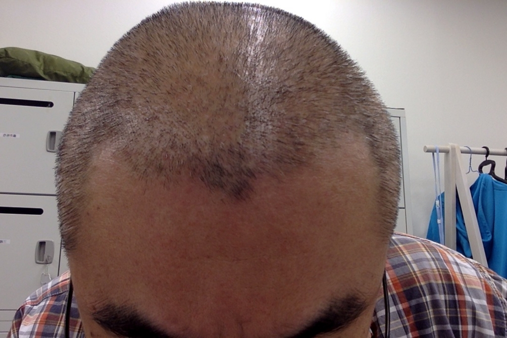 f:id:fujiitakuya:20150914185245j:plain f:id:fujiitakuya:20150914185245j:plain