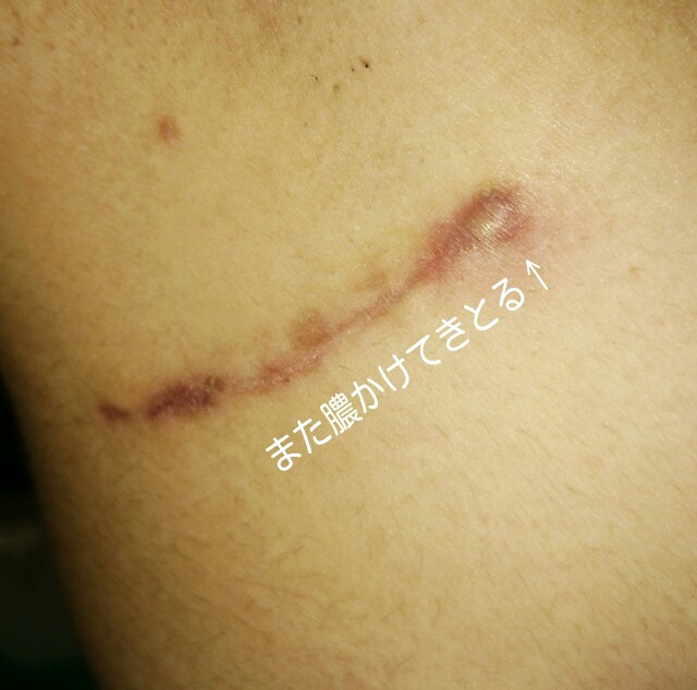 f:id:keroro06:20150611170717j:image f:id:keroro06:20150611170717j:image