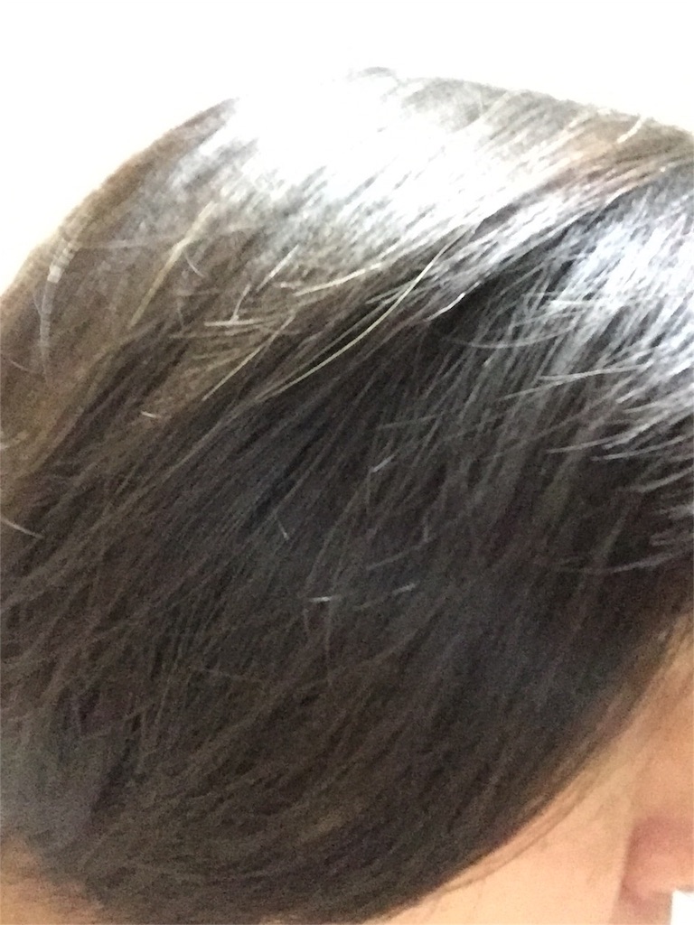 f:id:kodomotatinoegao:20151216232420j:image f:id:kodomotatinoegao:20151216232420j:image