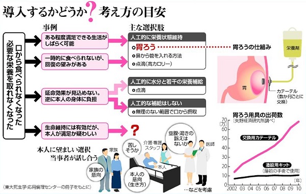 「胃瘻」の画像検索結果