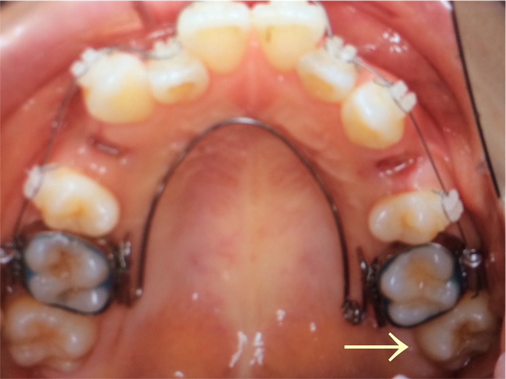f:id:makino-ortho:20151024225753j:image f:id:makino-ortho:20151024225753j:image