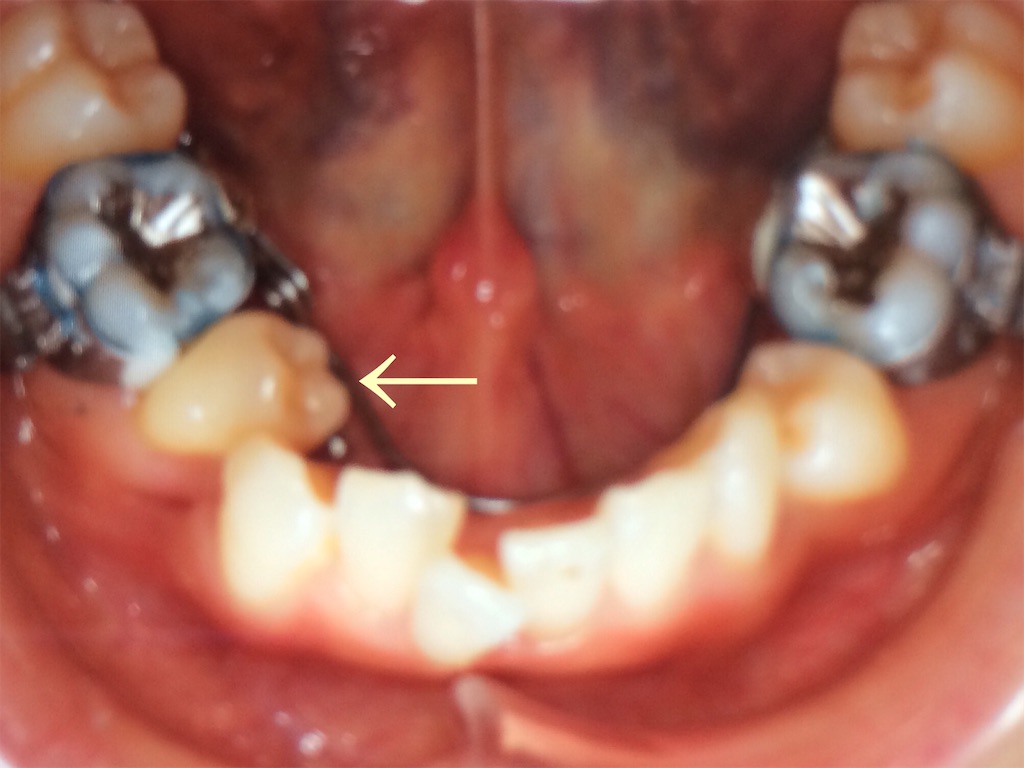 f:id:makino-ortho:20151024225854j:image f:id:makino-ortho:20151024225854j:image