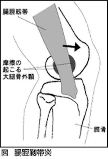 f:id:masa308gts:20150919010758g:image f:id:masa308gts:20150919010758g:image