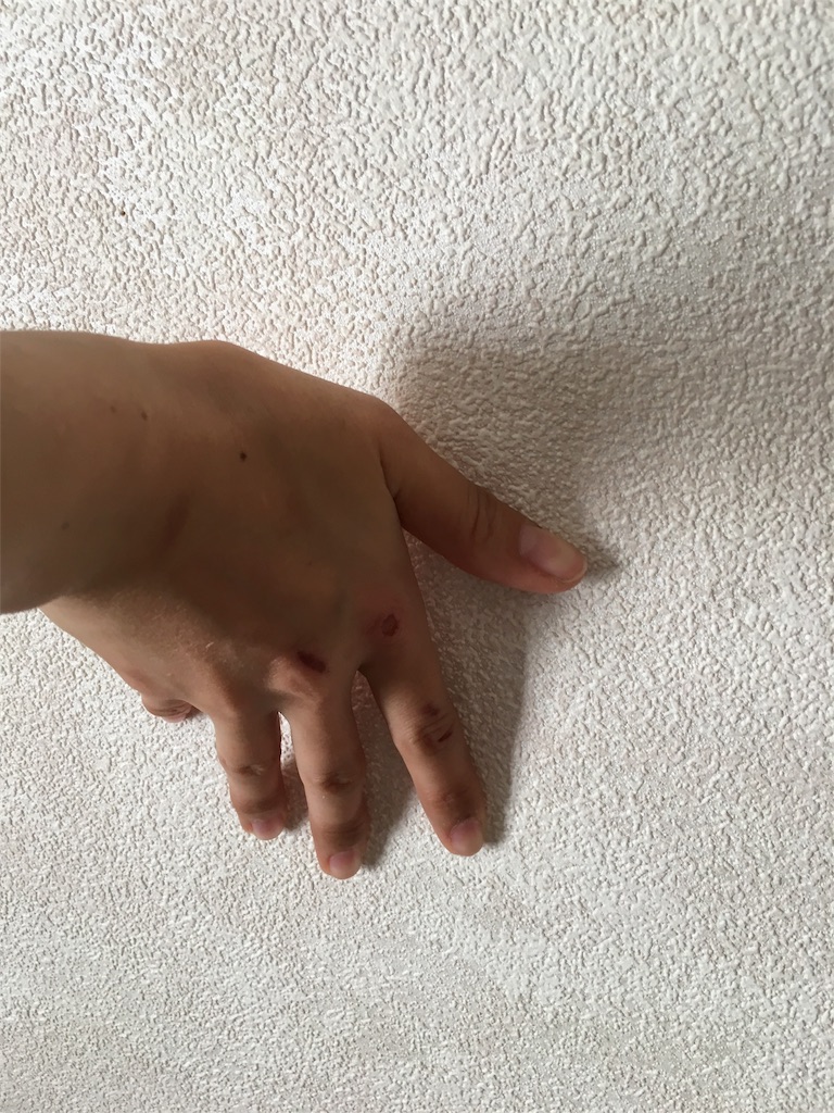 f:id:mikachiiiii:20151229071005j:image f:id:mikachiiiii:20151229071005j:image