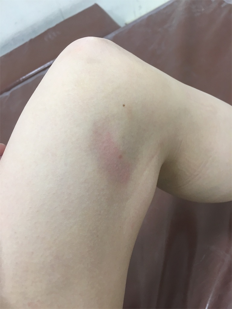 f:id:mikachiiiii:20160309070402j:image f:id:mikachiiiii:20160309070402j:image