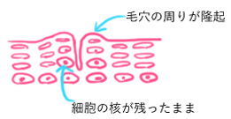 f:id:minolist:20160514193714j:plain f:id:minolist:20160514193714j:plain
