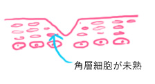 f:id:minolist:20160514193727j:plain f:id:minolist:20160514193727j:plain