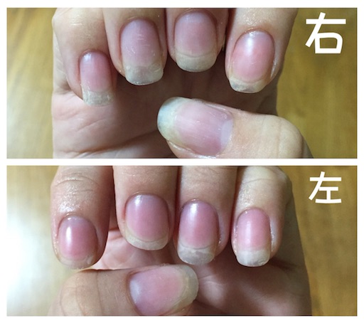 f:id:nailchanky:20160724214151j:image f:id:nailchanky:20160724214151j:image