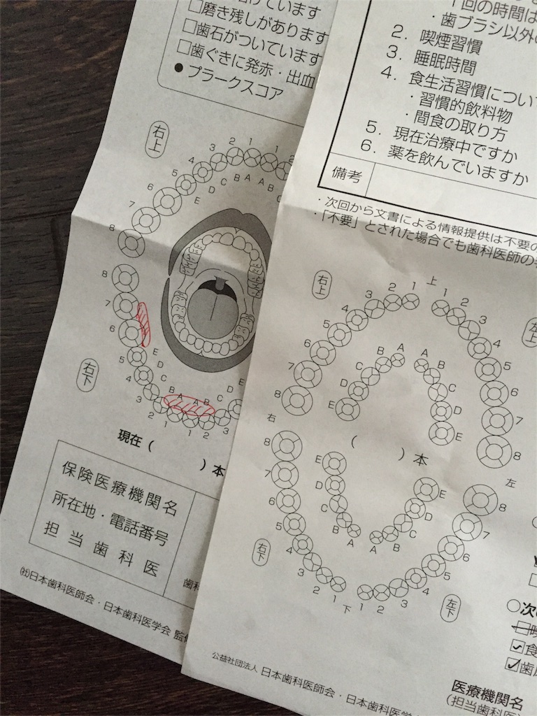 f:id:nonkey_monkey:20151108145317j:image f:id:nonkey_monkey:20151108145317j:image