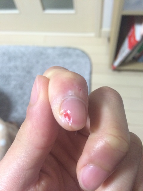 f:id:nukenin21:20150222115615j:plain f:id:nukenin21:20150222115615j:plain