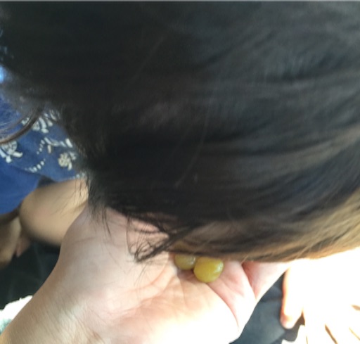 f:id:outdoor-kanazawa:20150922152835j:image f:id:outdoor-kanazawa:20150922152835j:image