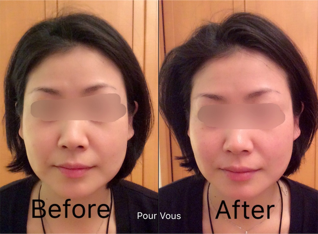 f:id:pourvous:20160425232731j:image f:id:pourvous:20160425232731j:image