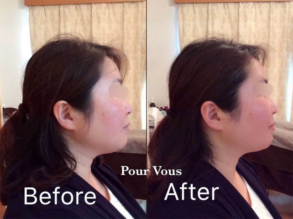 f:id:pourvous:20160425232805j:image f:id:pourvous:20160425232805j:image