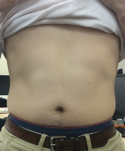 f:id:ringboy:20140519174223j:plain f:id:ringboy:20140519174223j:plain