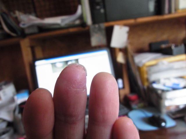 f:id:satoyamanoyume:20151125173122j:plain f:id:satoyamanoyume:20151125173122j:plain