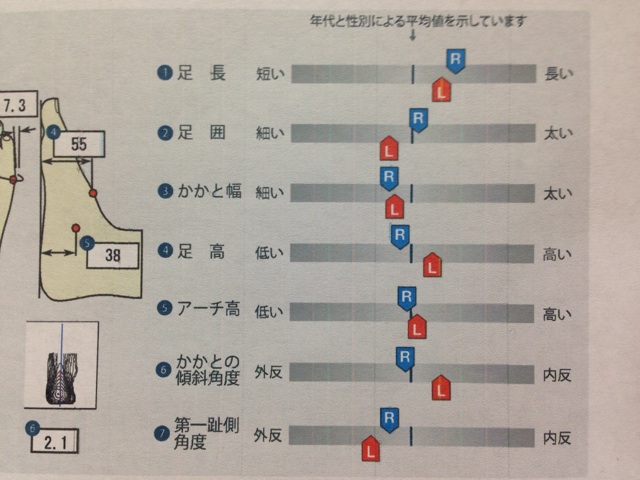 f:id:shin_kuroiwa:20140805224925j:plain f:id:shin_kuroiwa:20140805224925j:plain