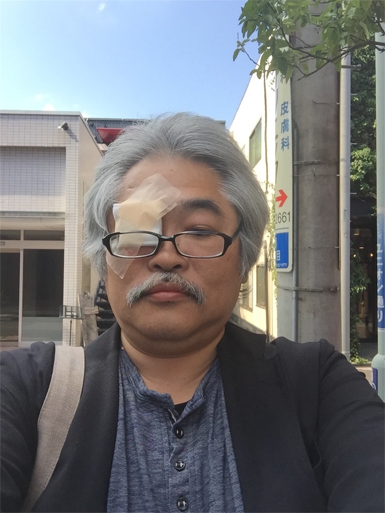 f:id:sleepshow:20160603182018j:image f:id:sleepshow:20160603182018j:image