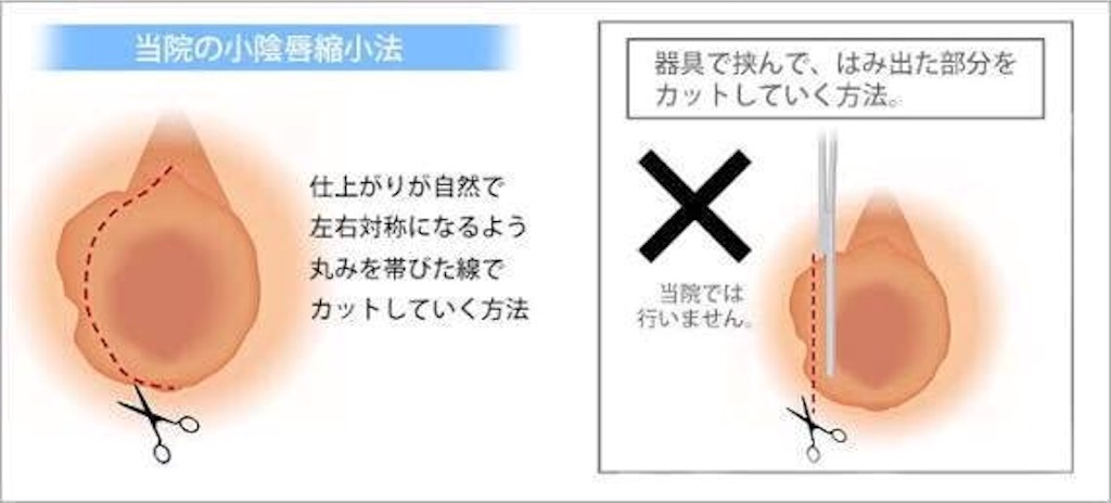 f:id:soiasla13296132:20151026235716j:image f:id:soiasla13296132:20151026235716j:image