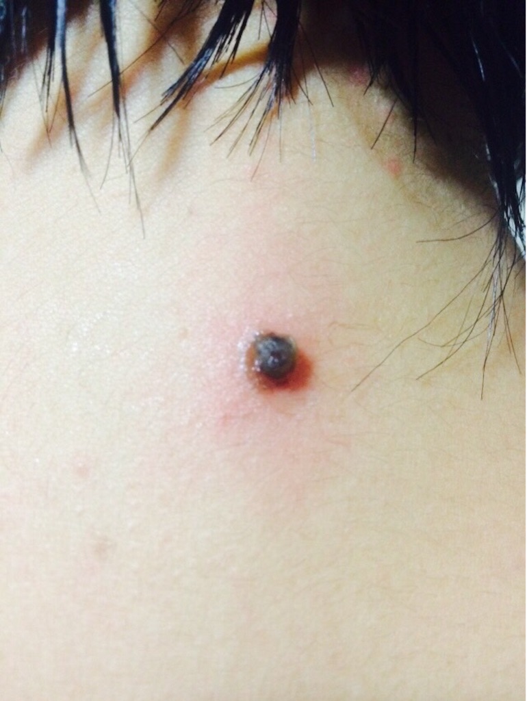 f:id:sorairo2000:20150803125647j:image f:id:sorairo2000:20150803125647j:image