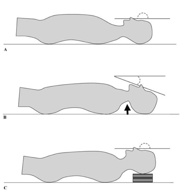 f:id:takumasa39:20150208234432p:plain