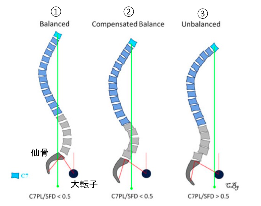 f:id:takumasa39:20150222184811p:plain