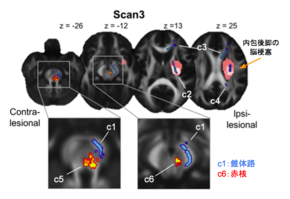 f:id:takumasa39:20160121120653p:plain f:id:takumasa39:20160121120653p:plain