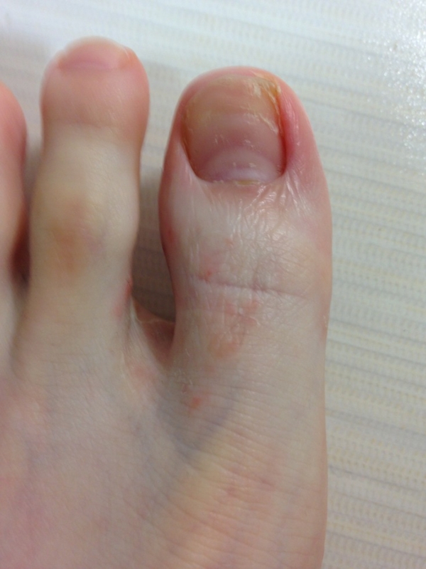 f:id:tsugi-hagi:20150702221519j:plain f:id:tsugi-hagi:20150702221519j:plain