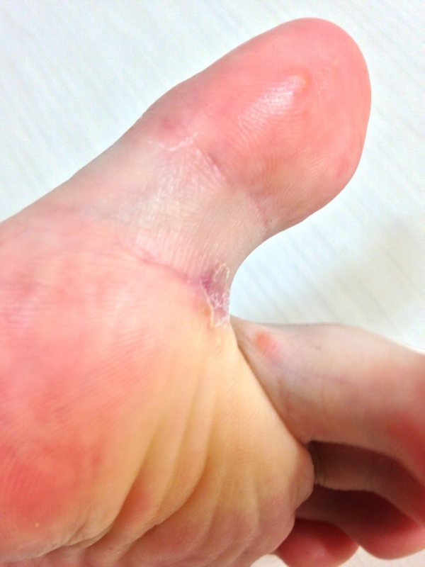 f:id:tsugi-hagi:20150702221521j:plain f:id:tsugi-hagi:20150702221521j:plain