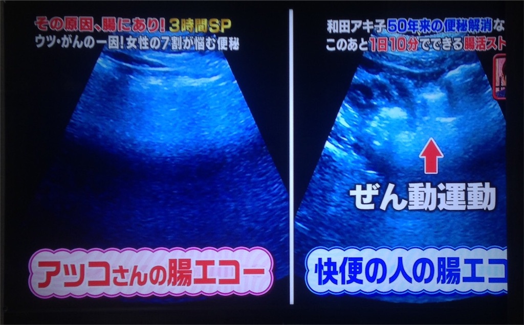 f:id:y-bono-k:20160424200504j:image f:id:y-bono-k:20160424200504j:image