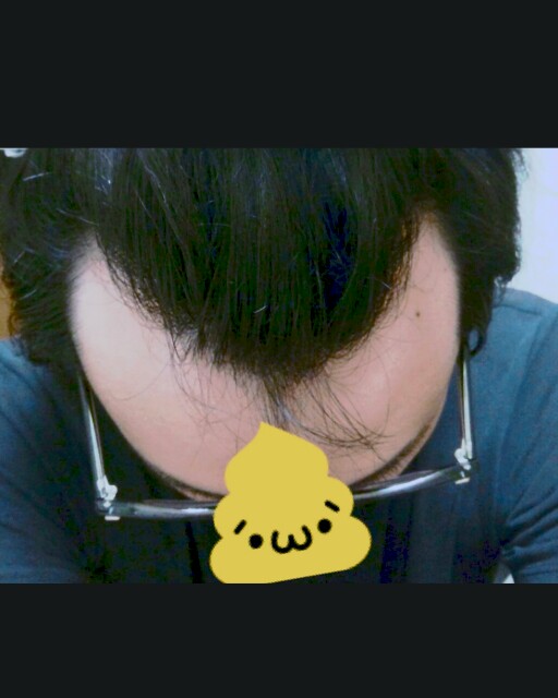 f:id:yellowkokeshi:20150825180740j:image f:id:yellowkokeshi:20150825180740j:image